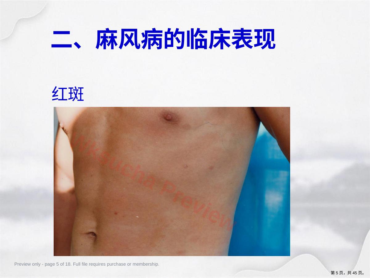 预览第 5 页