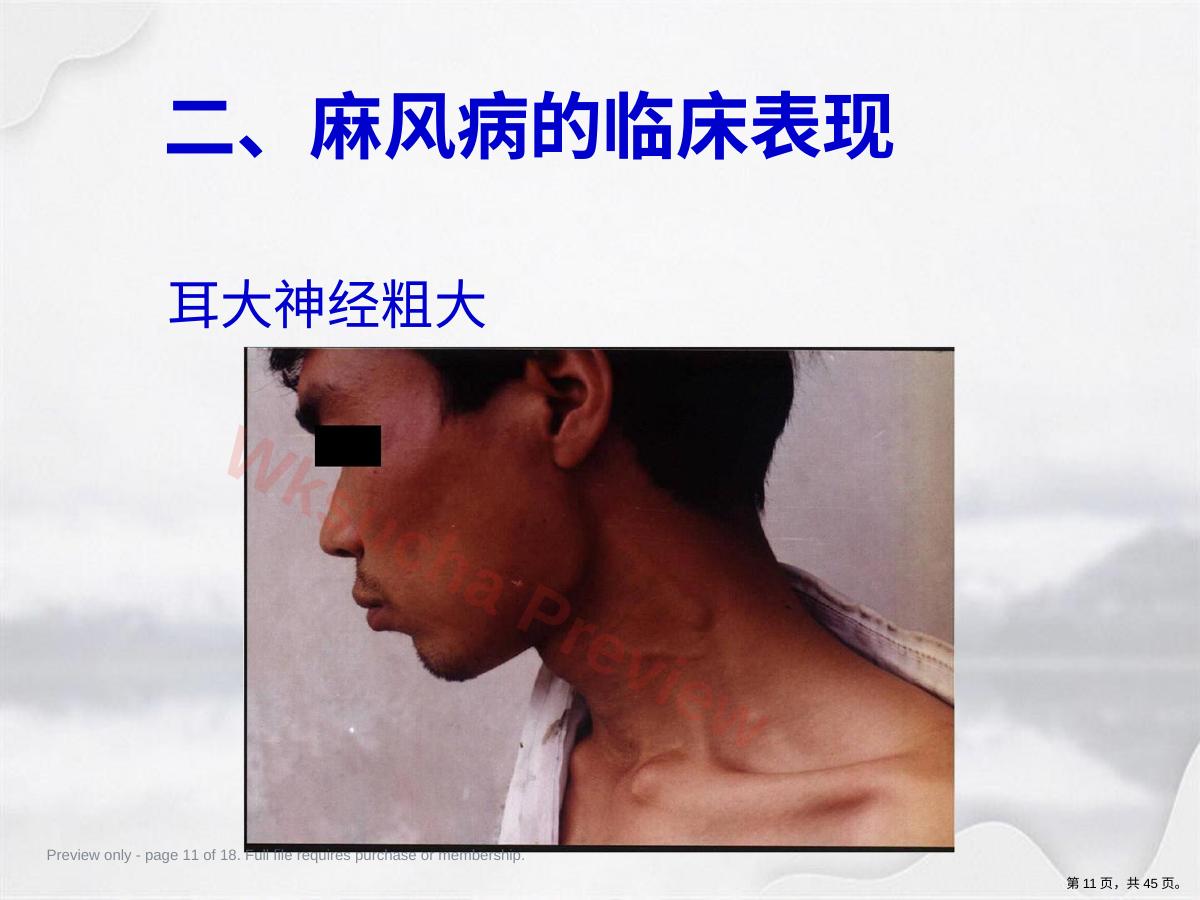 预览第 11 页