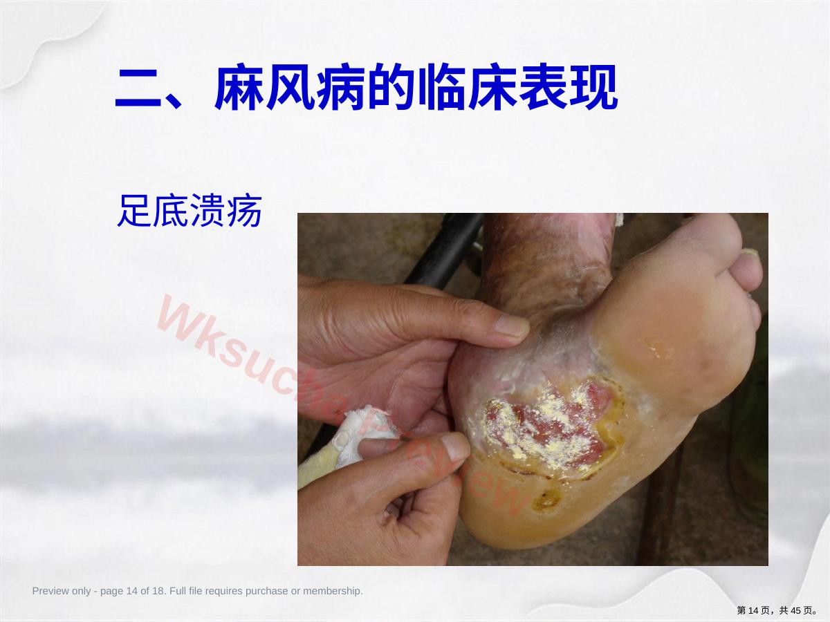 预览第 14 页
