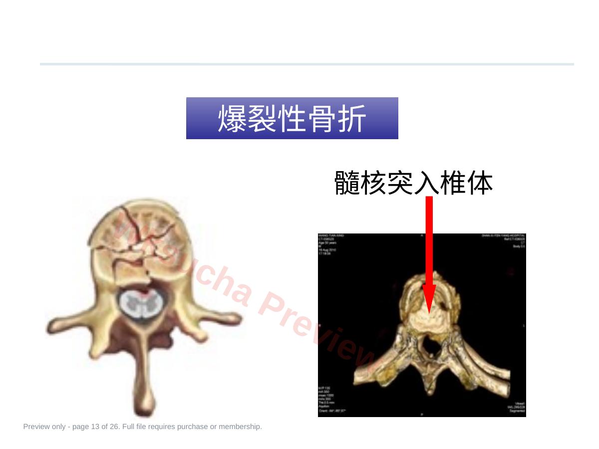 预览第 13 页
