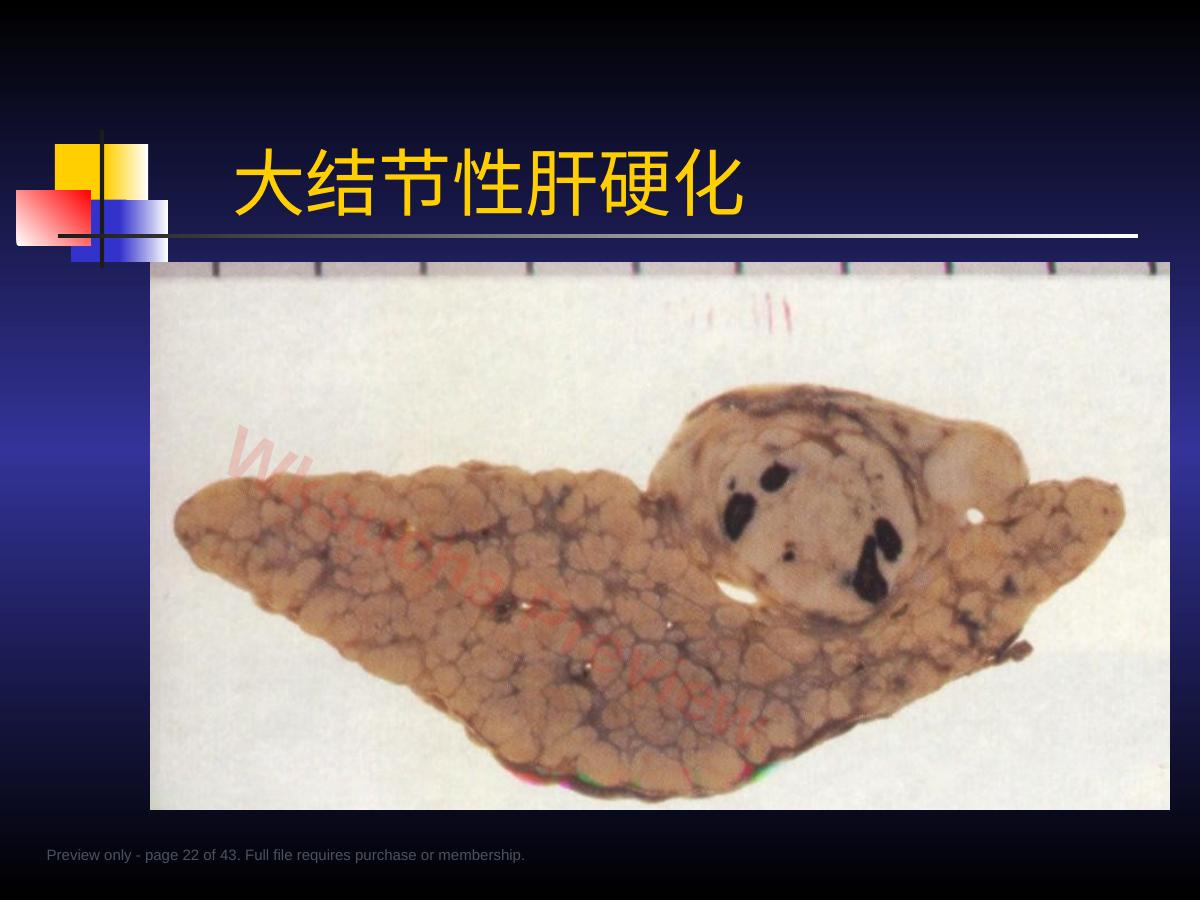预览第 22 页