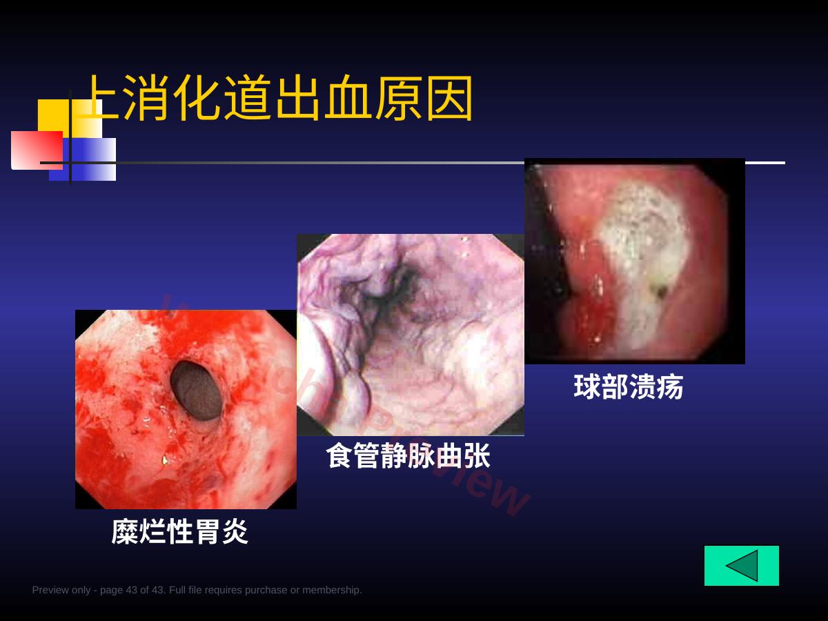 预览第 43 页