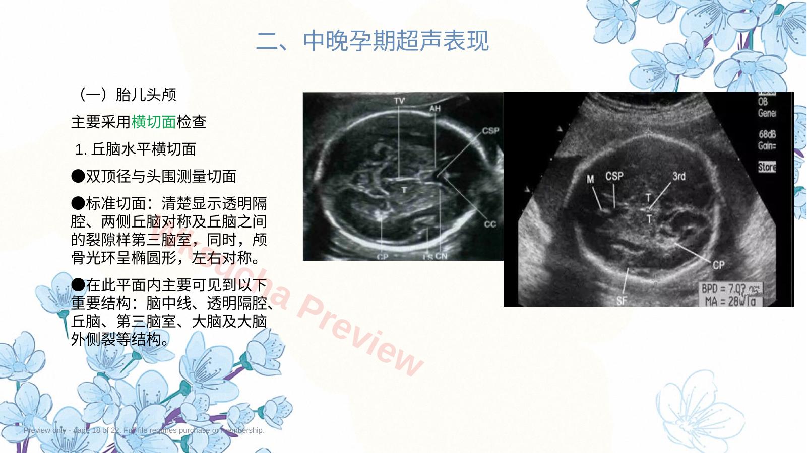 预览第 18 页