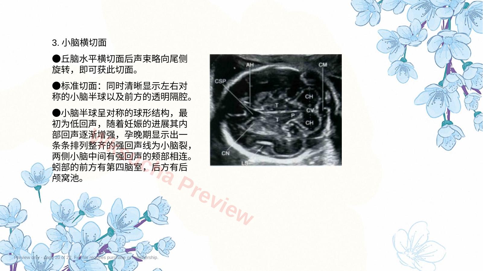 预览第 20 页