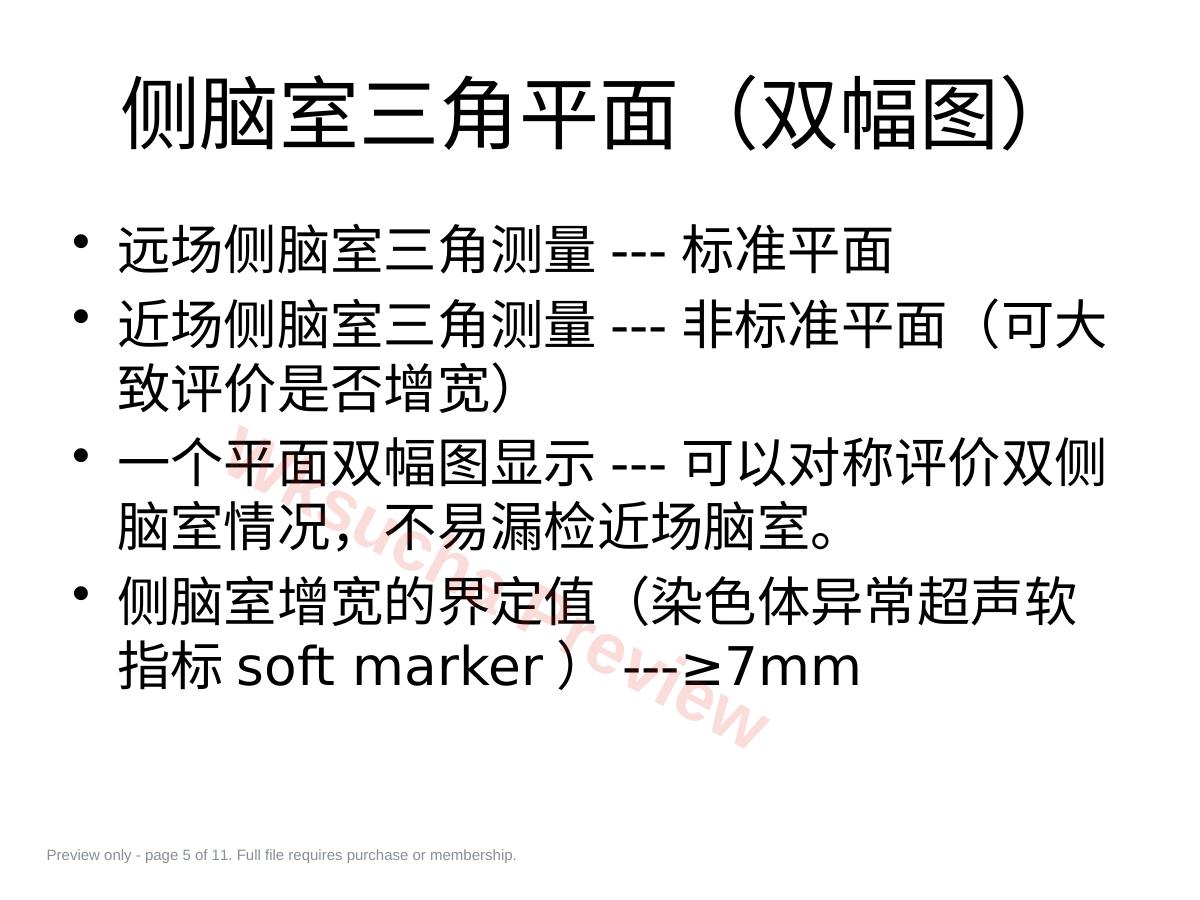 预览第 5 页