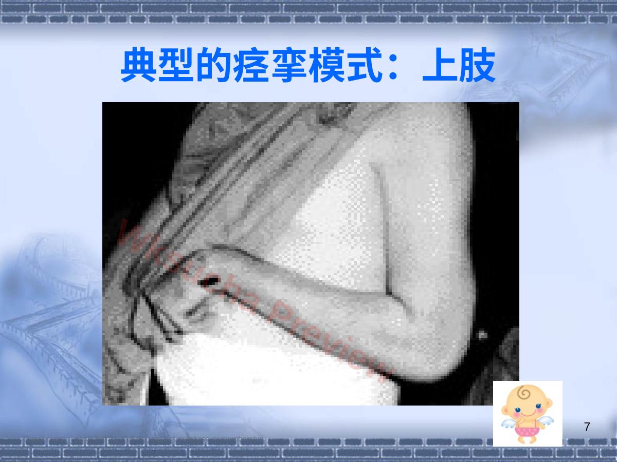 预览第 7 页