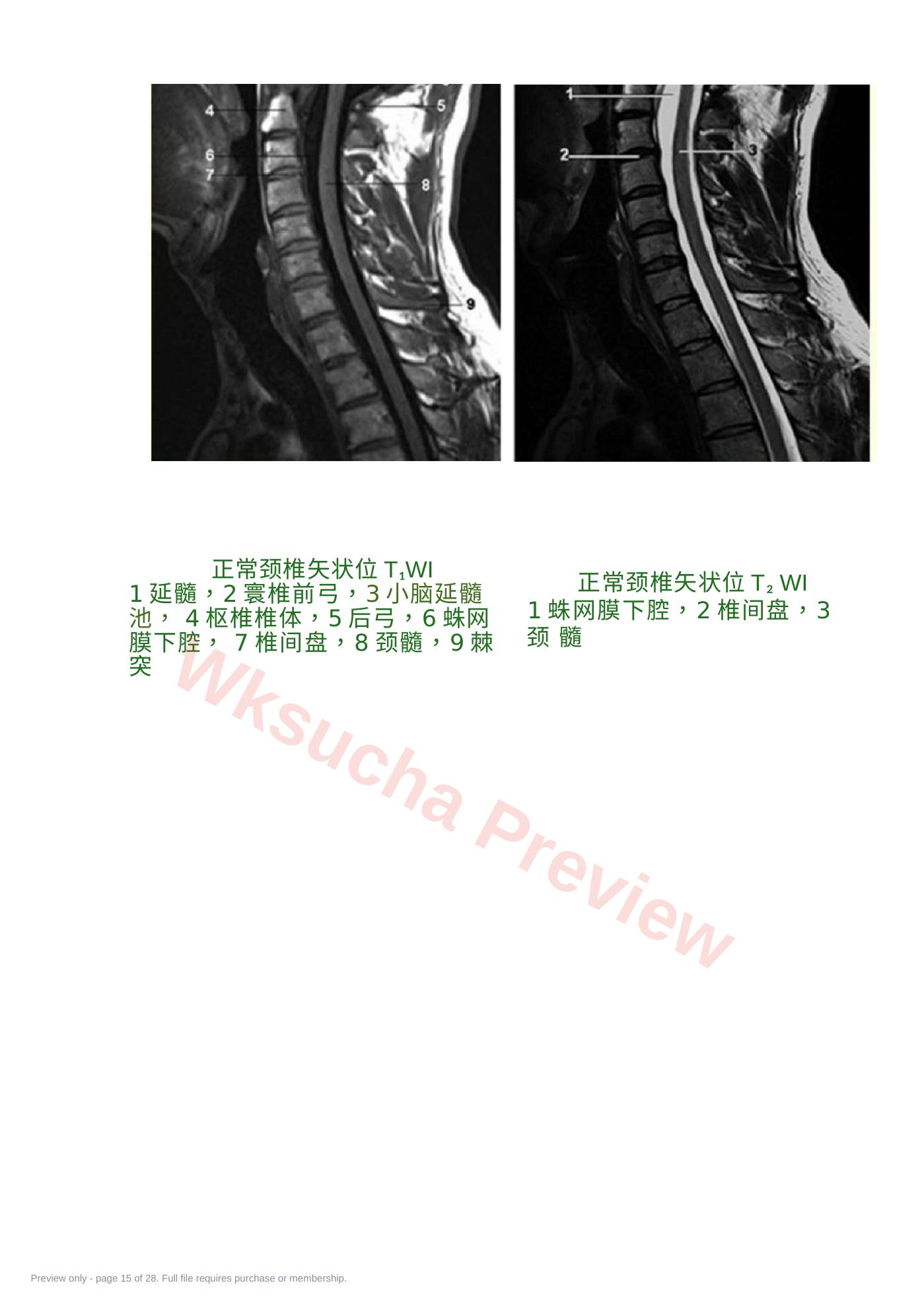 预览第 15 页