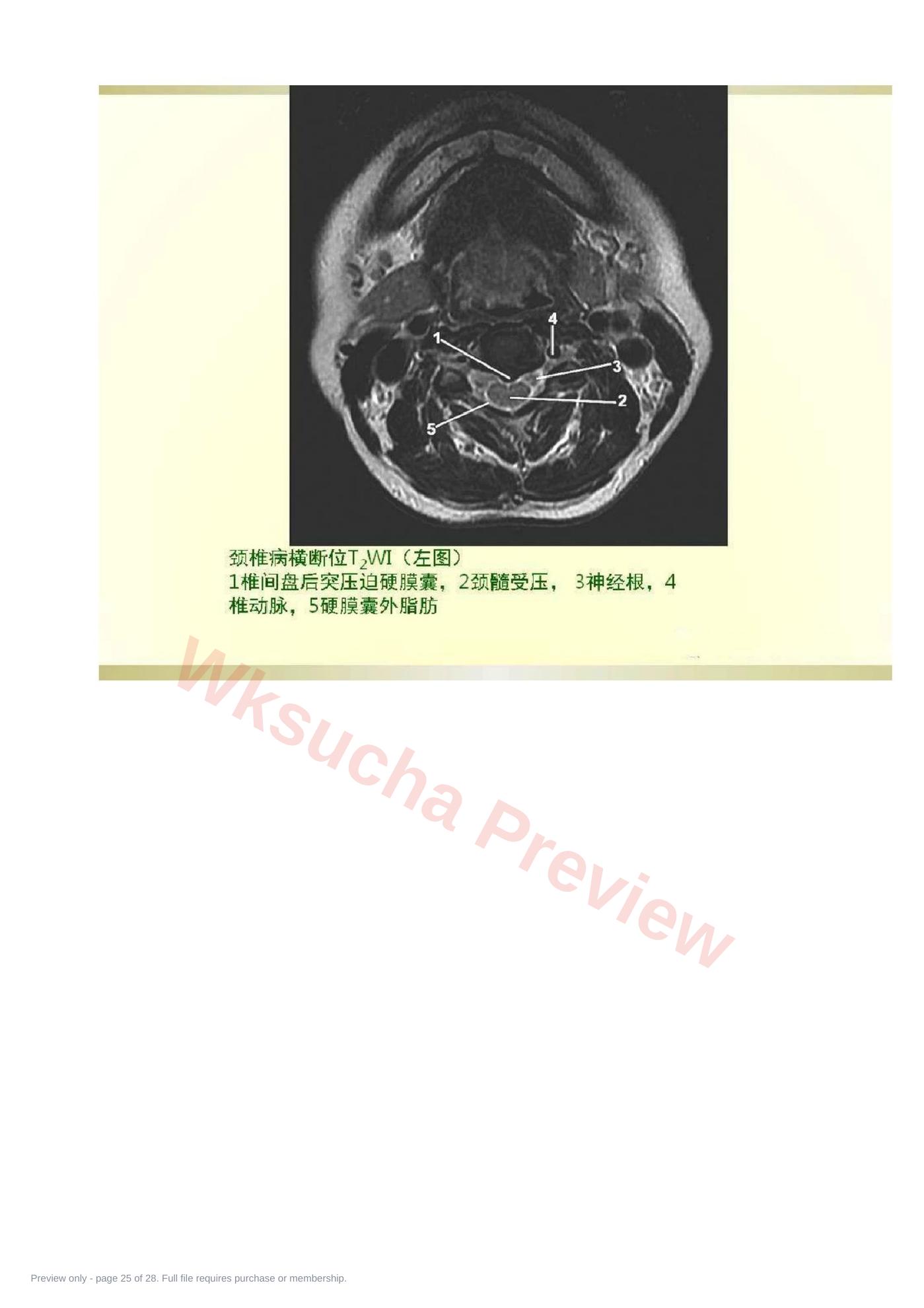 预览第 25 页