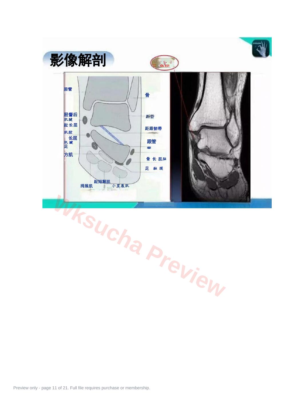 预览第 11 页