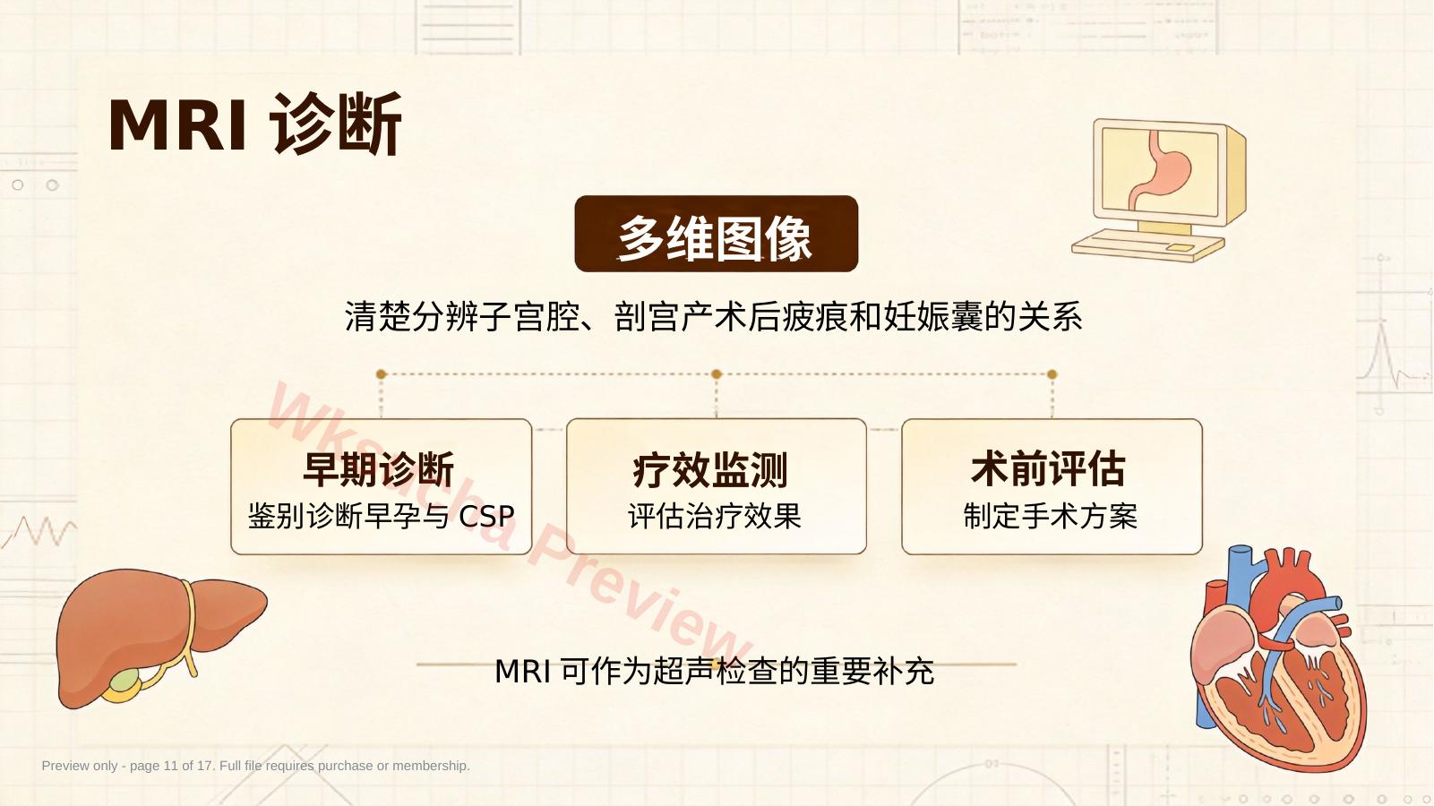 预览第 11 页