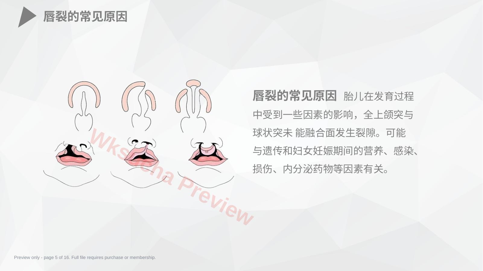 预览第 5 页