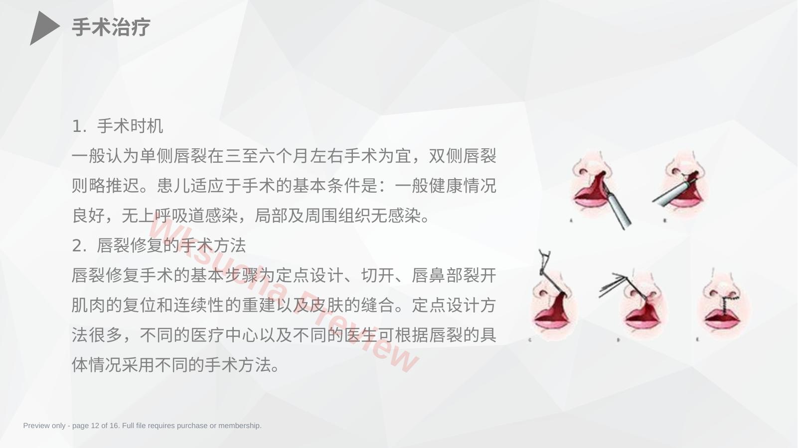 预览第 12 页