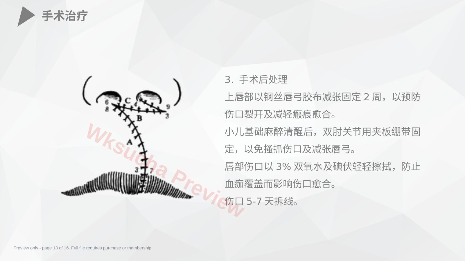预览第 13 页