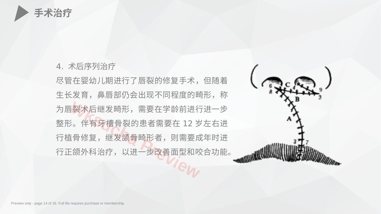 预览第 14 页