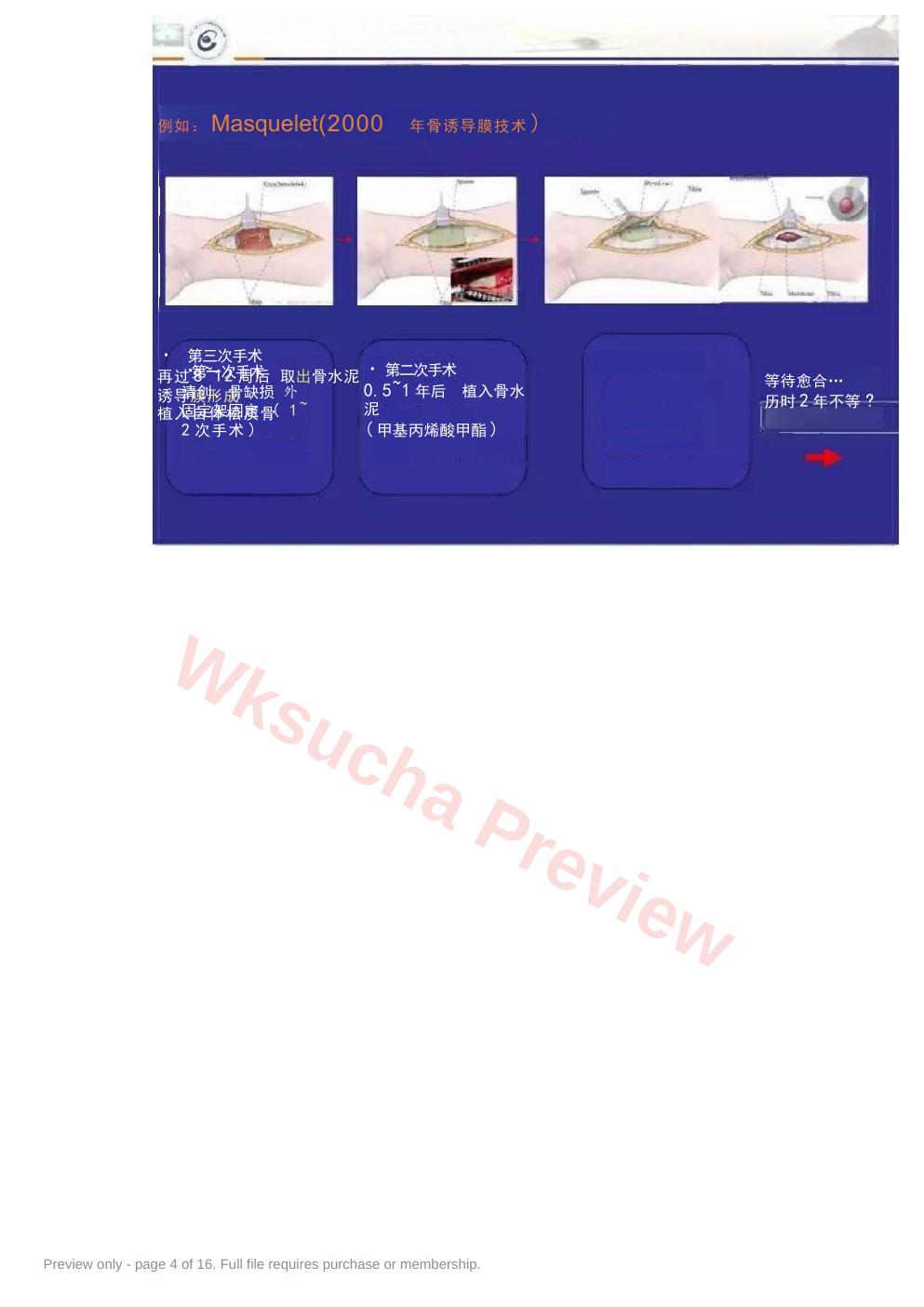 预览第 4 页