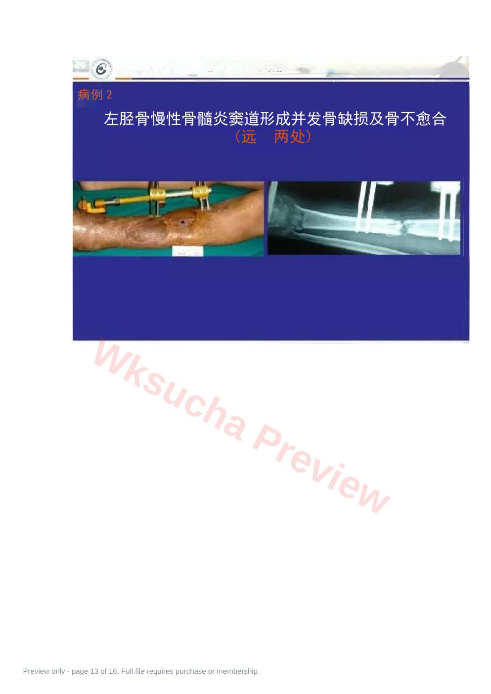 预览第 13 页
