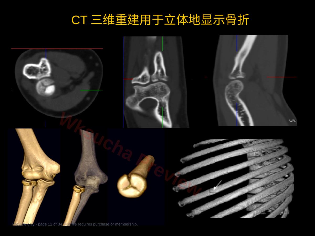预览第 11 页