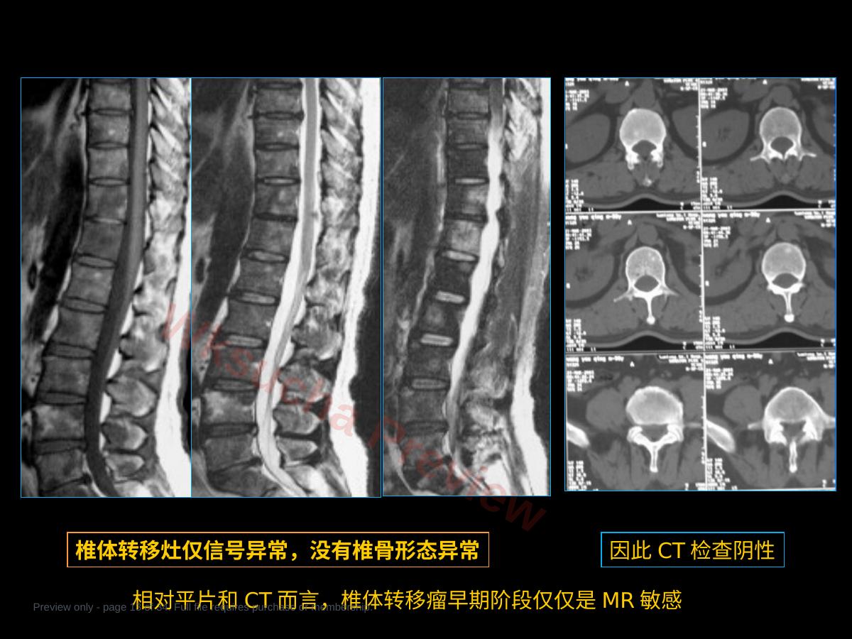 预览第 13 页