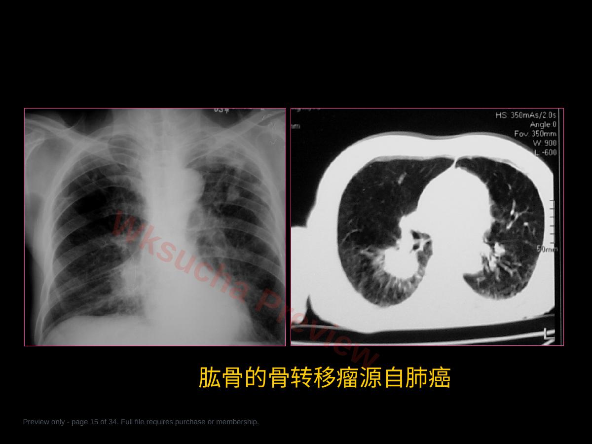 预览第 15 页