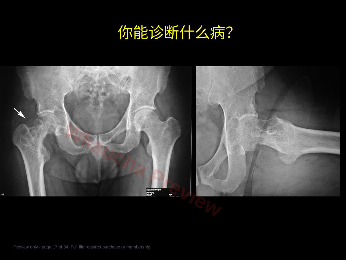 预览第 17 页