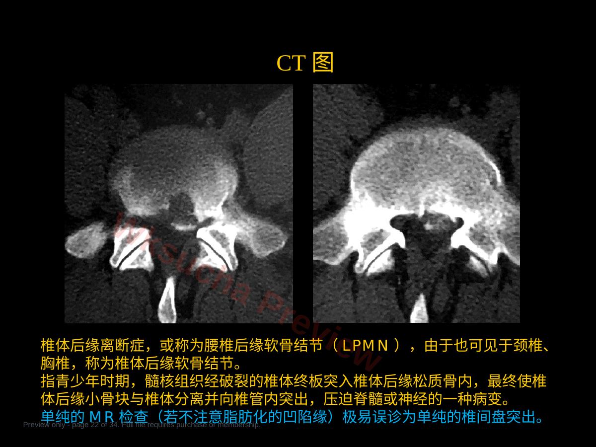 预览第 22 页