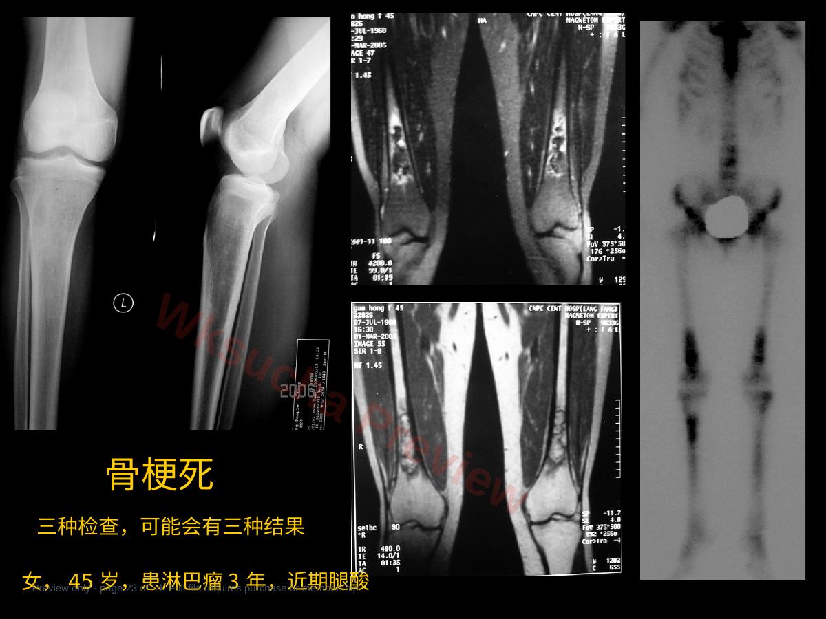 预览第 23 页