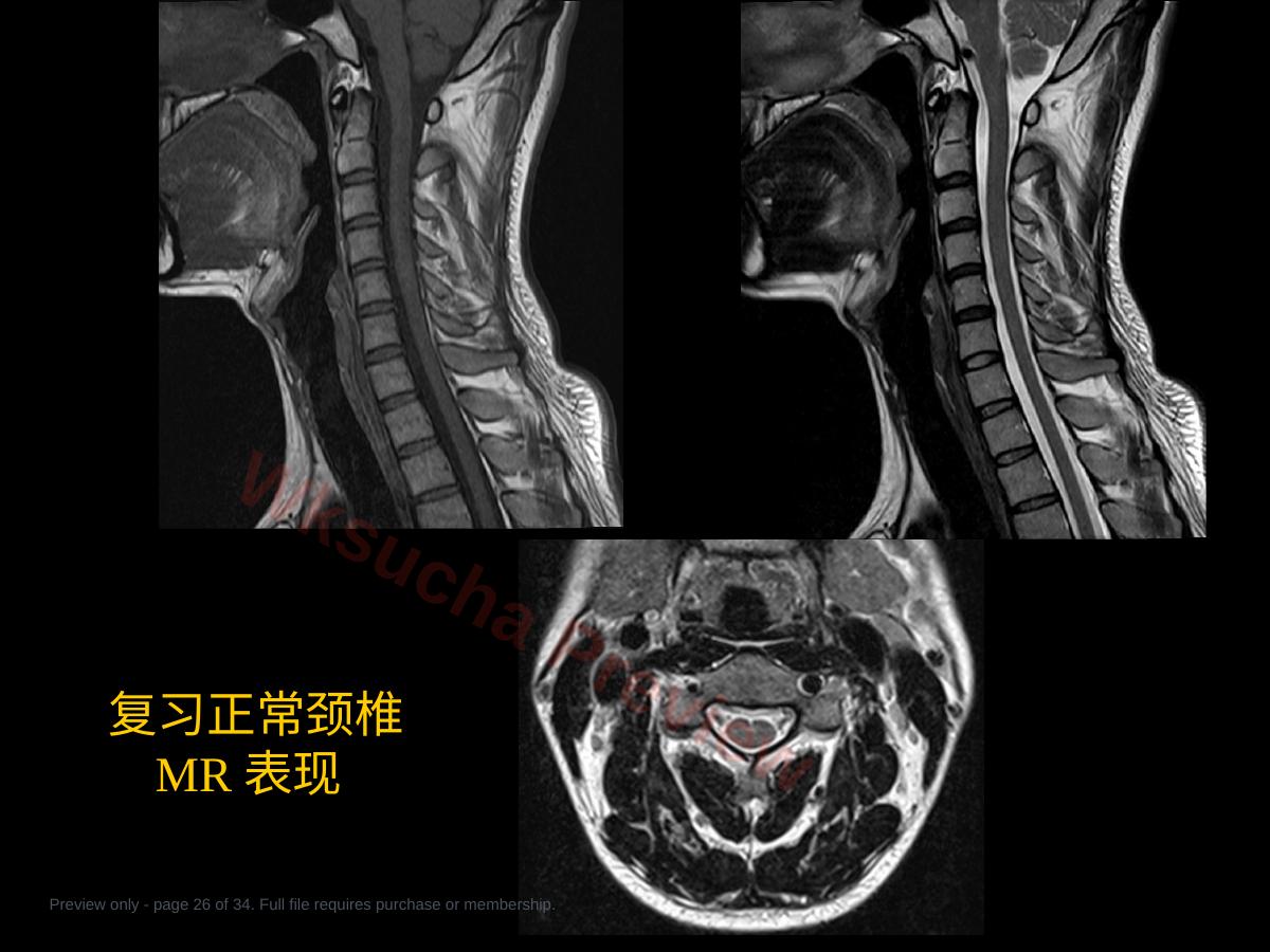 预览第 26 页