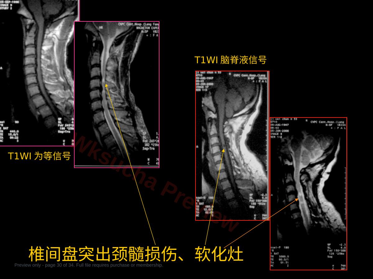 预览第 30 页