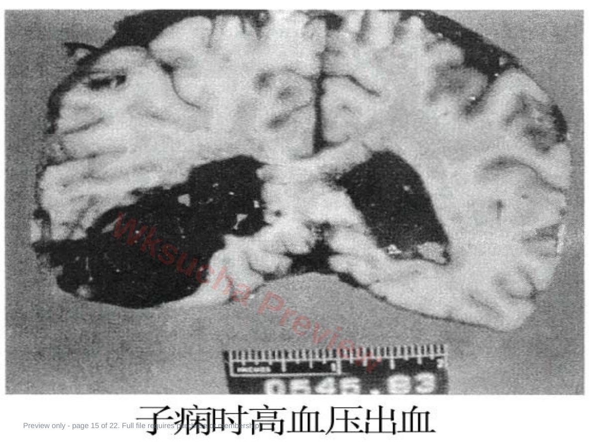 预览第 15 页