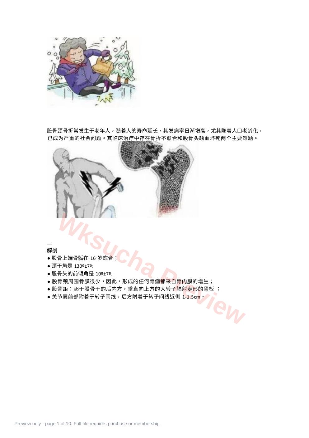 股骨颈骨折的分型与治疗策略