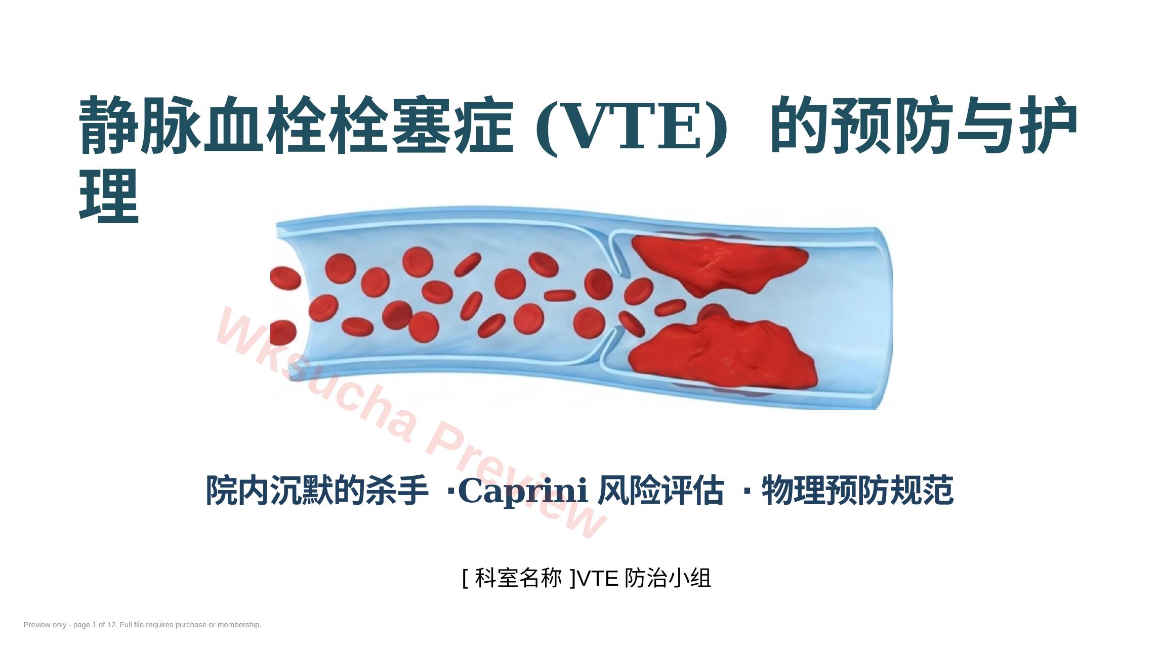 vte静脉血栓的预防与护理