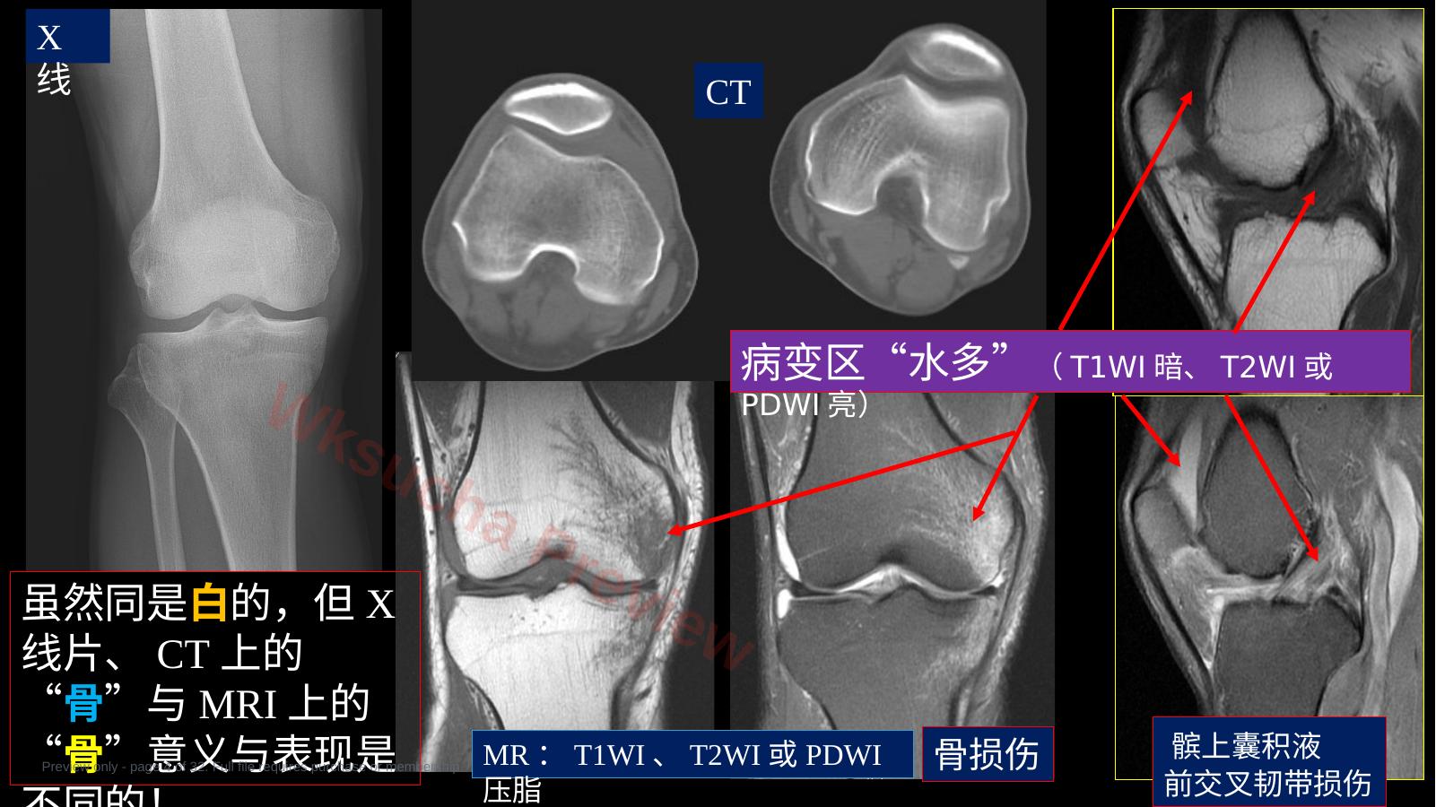 预览第 4 页