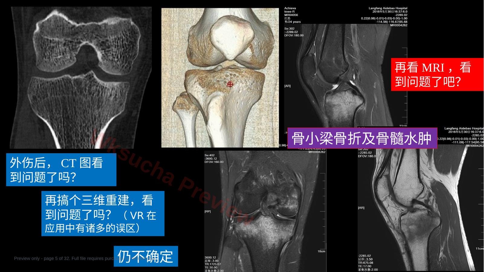 预览第 5 页