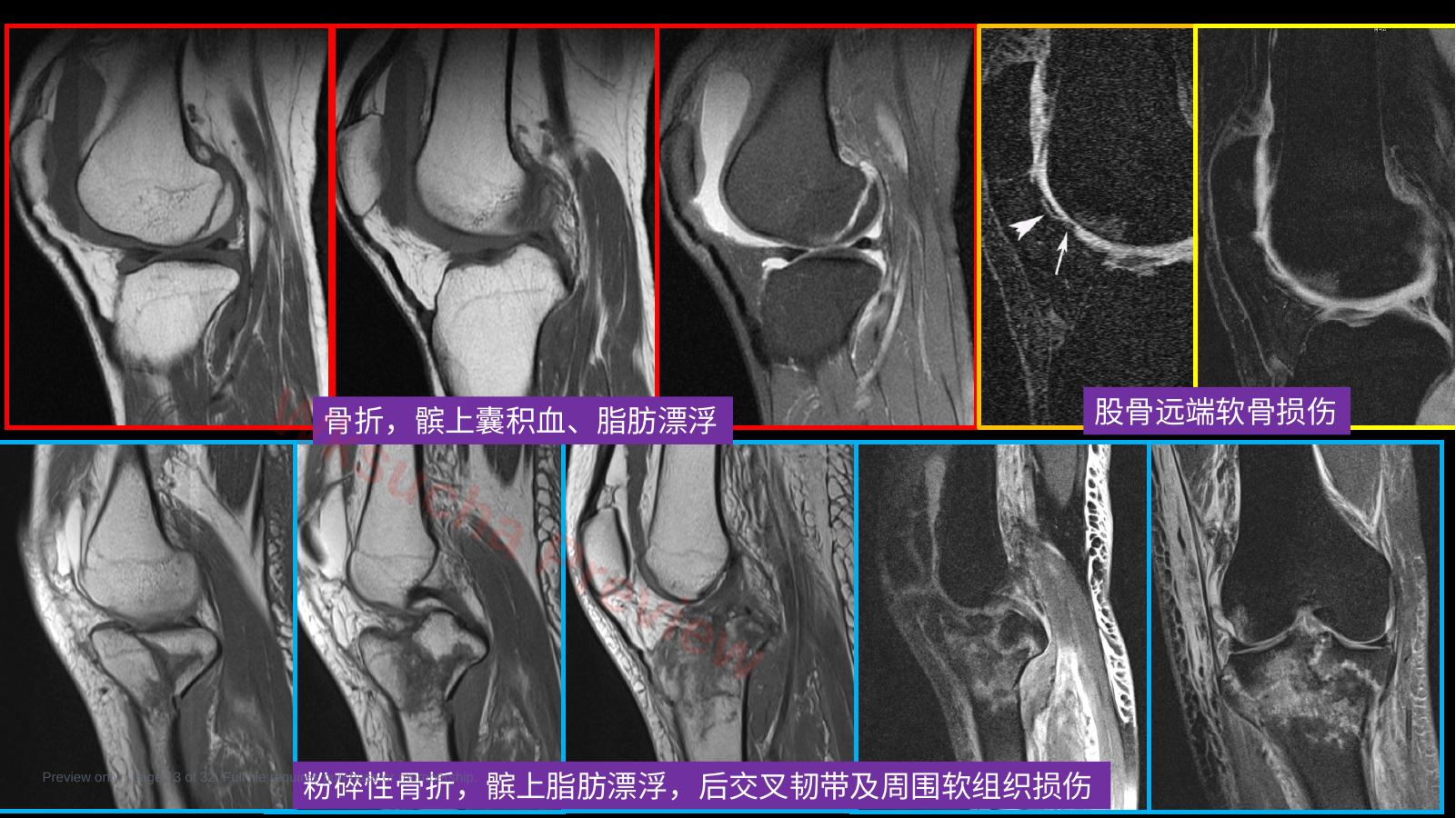 预览第 13 页