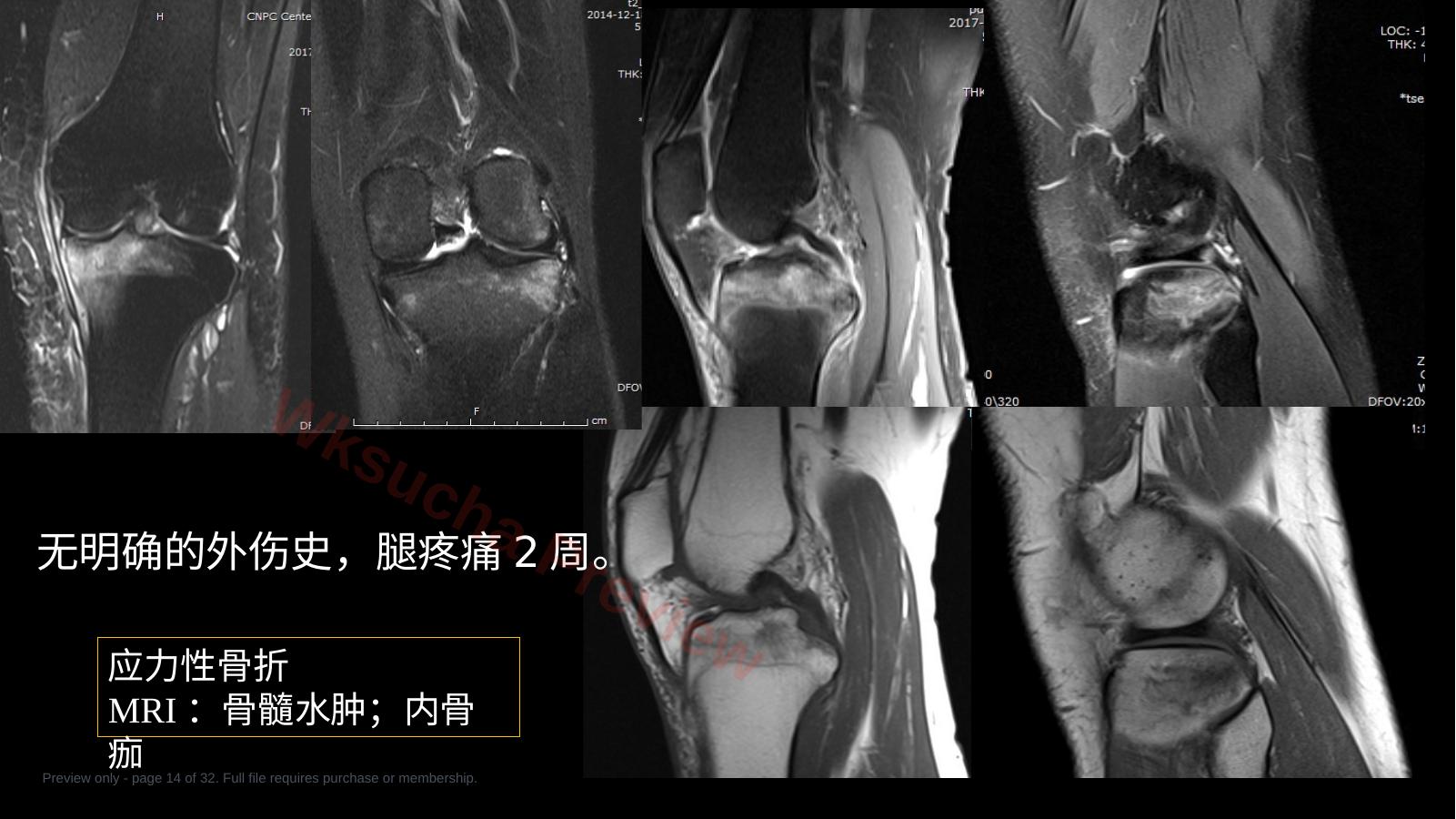 预览第 14 页