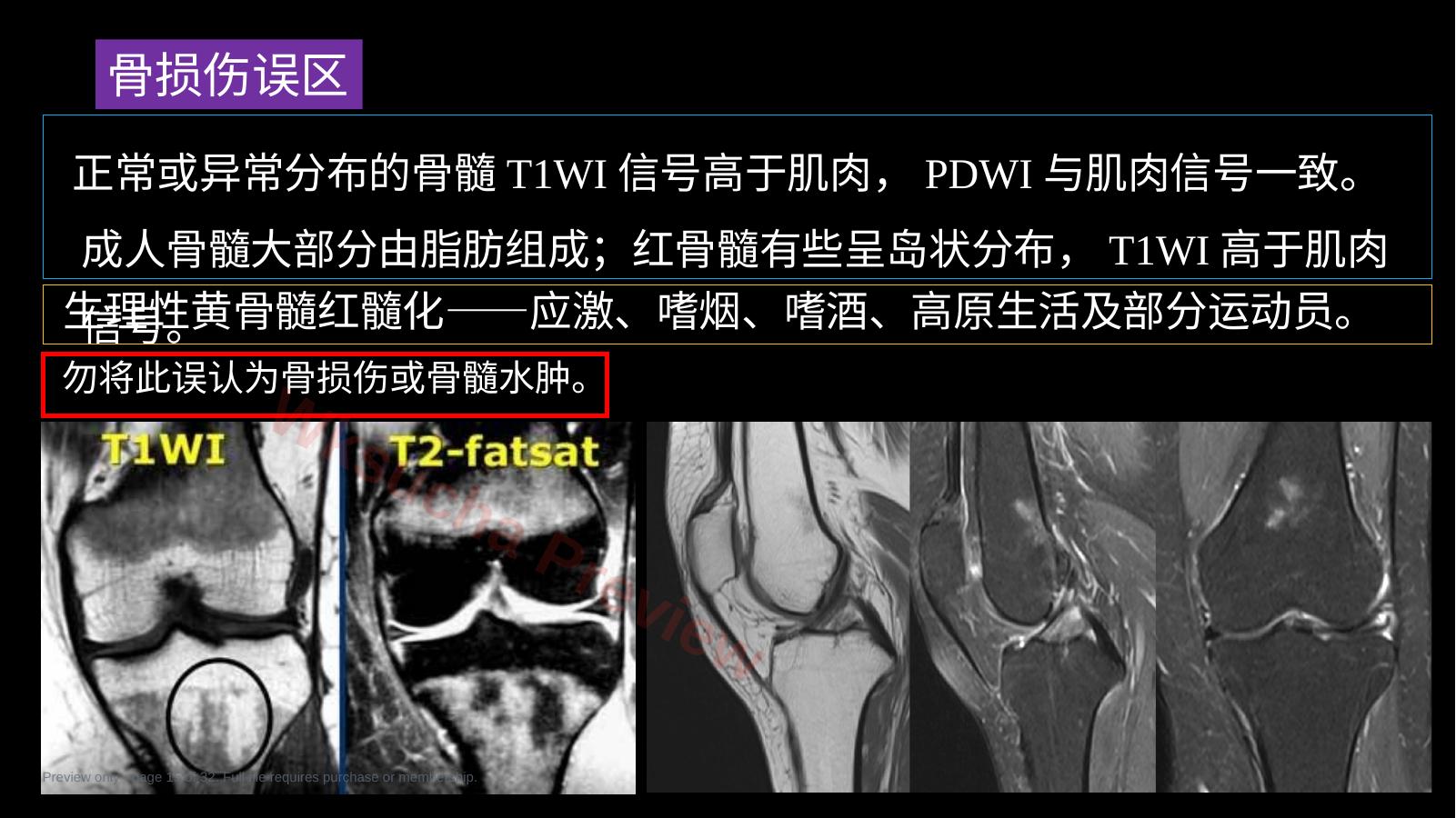 预览第 15 页