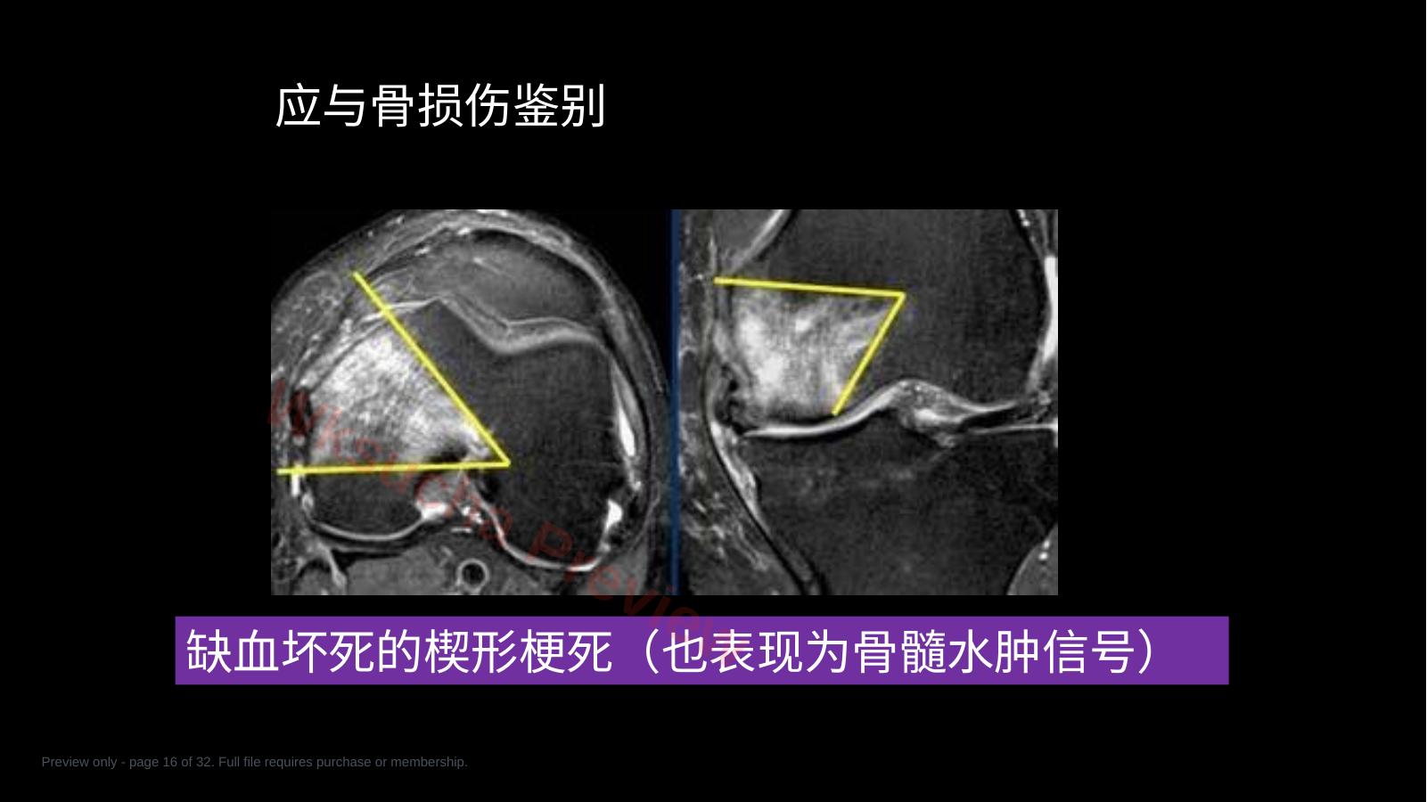 预览第 16 页