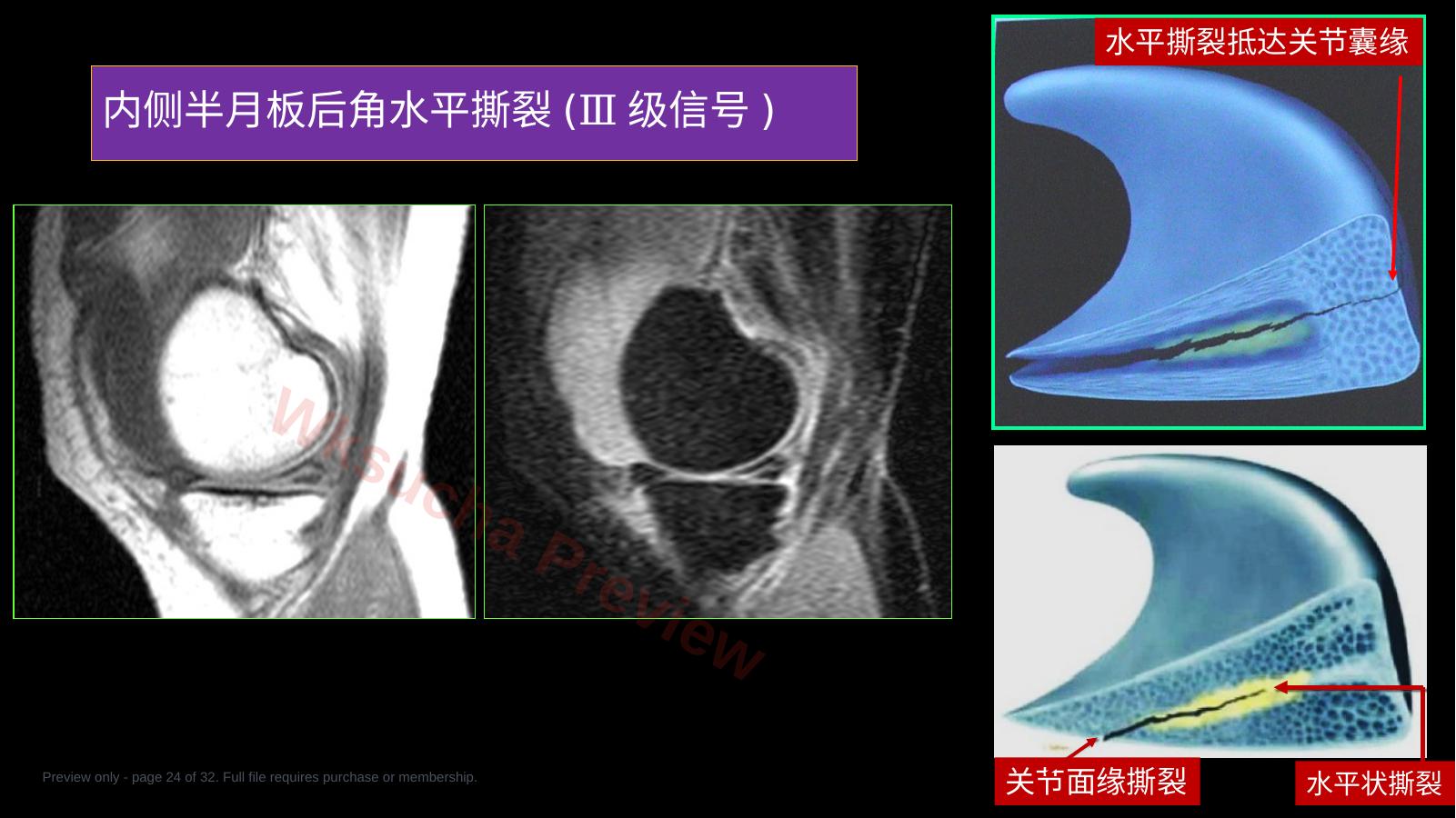 预览第 24 页