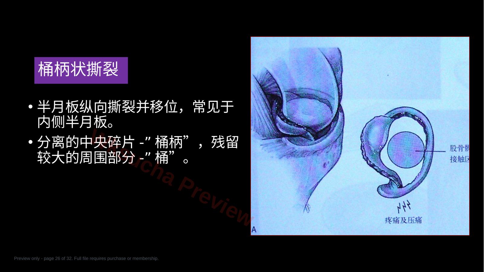 预览第 26 页