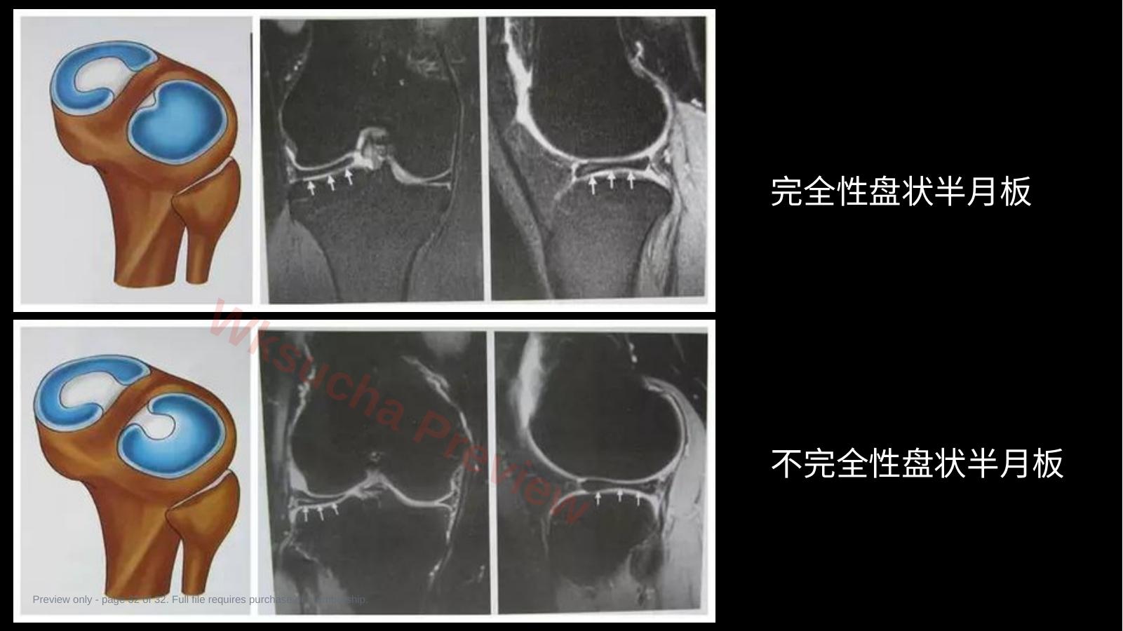 预览第 32 页