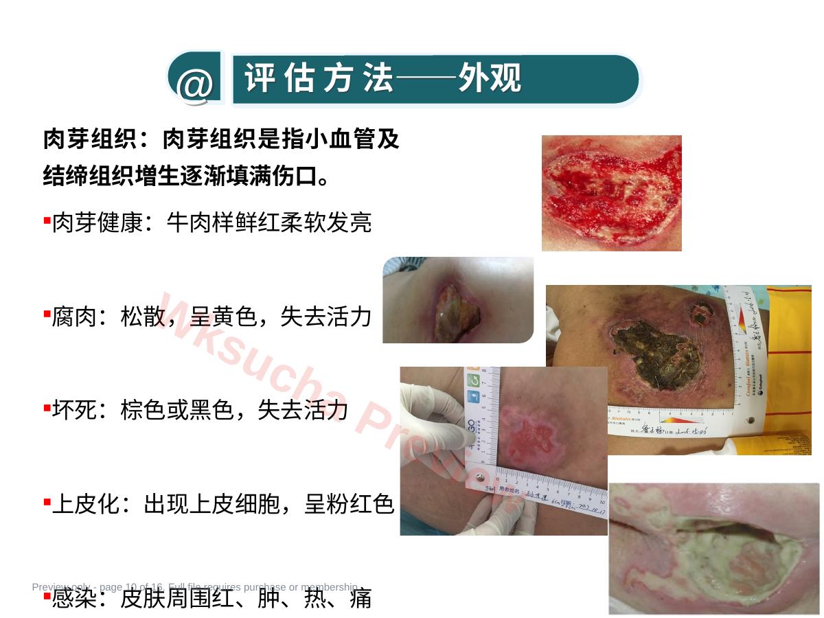预览第 10 页