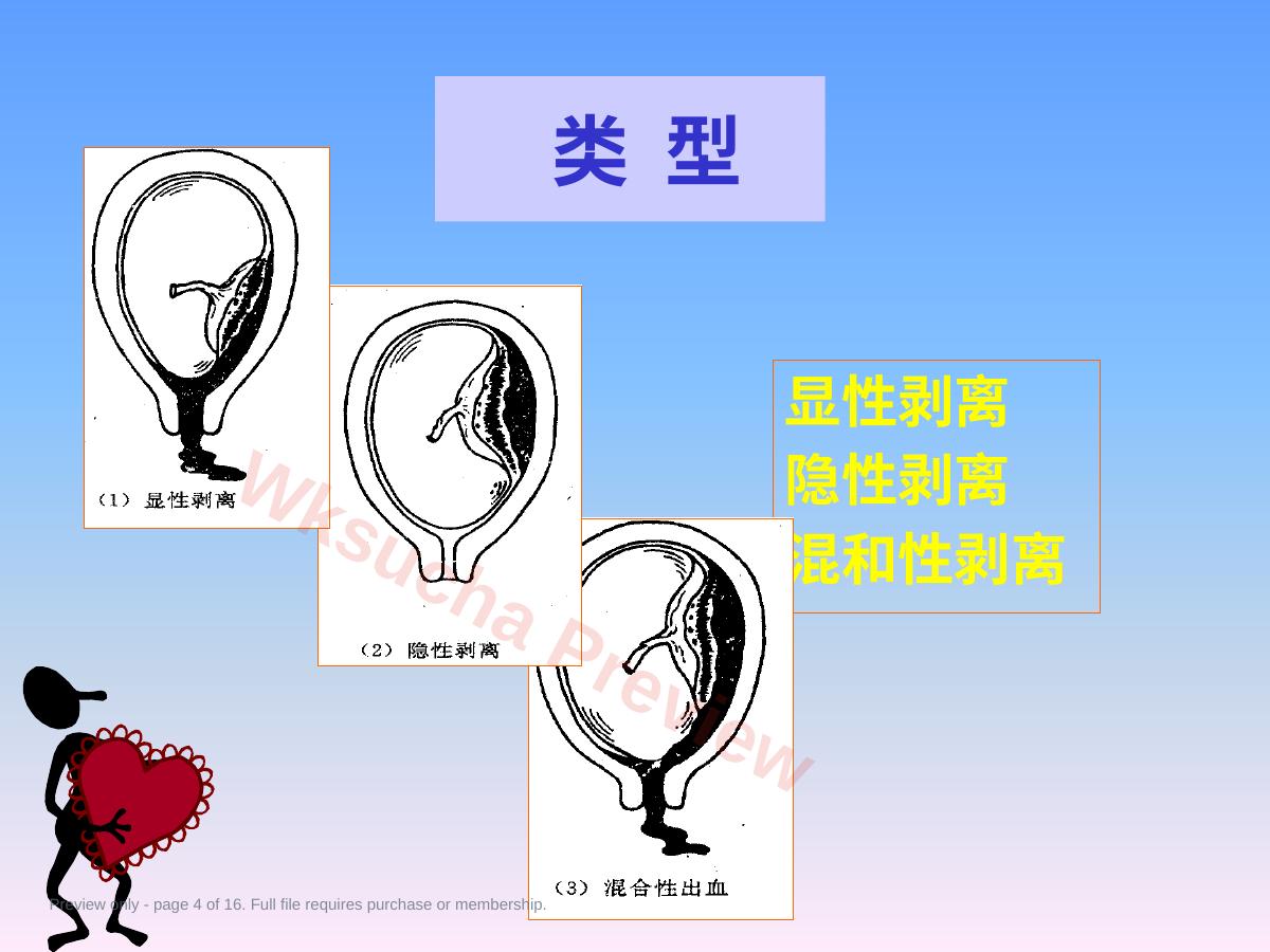 预览第 4 页