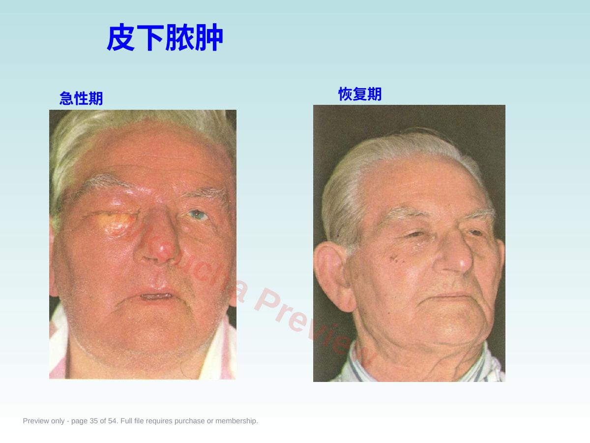 预览第 35 页