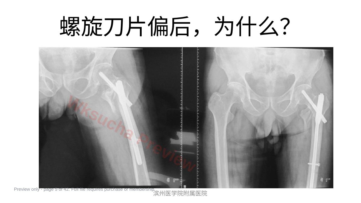 预览第 5 页