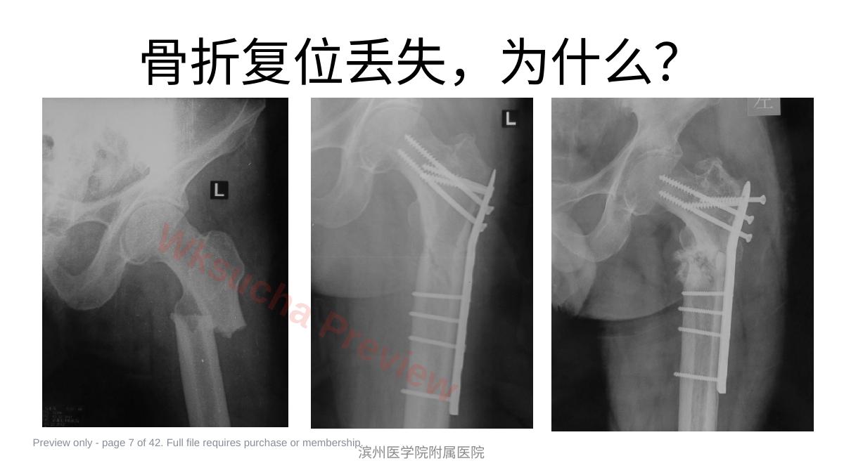 预览第 7 页