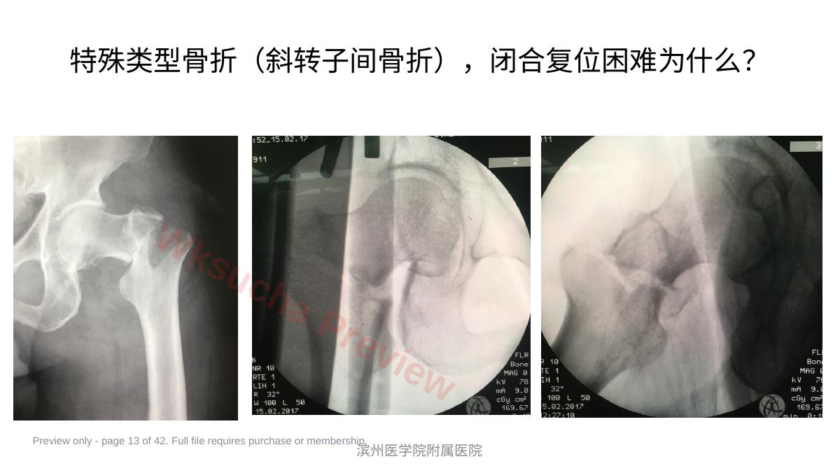 预览第 13 页