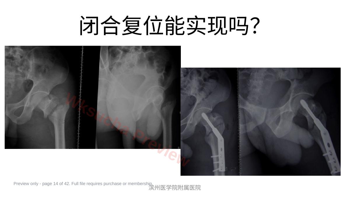 预览第 14 页