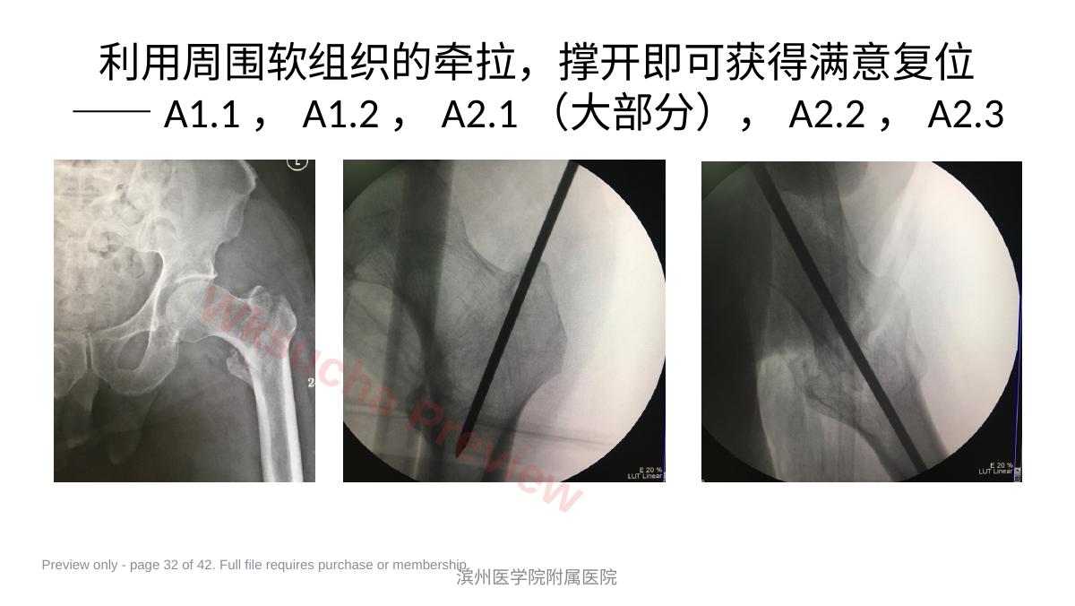 预览第 32 页