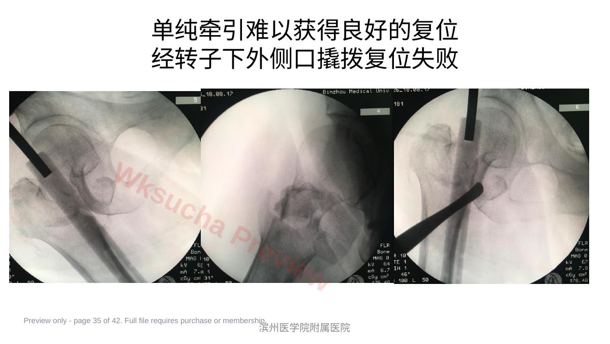 预览第 35 页