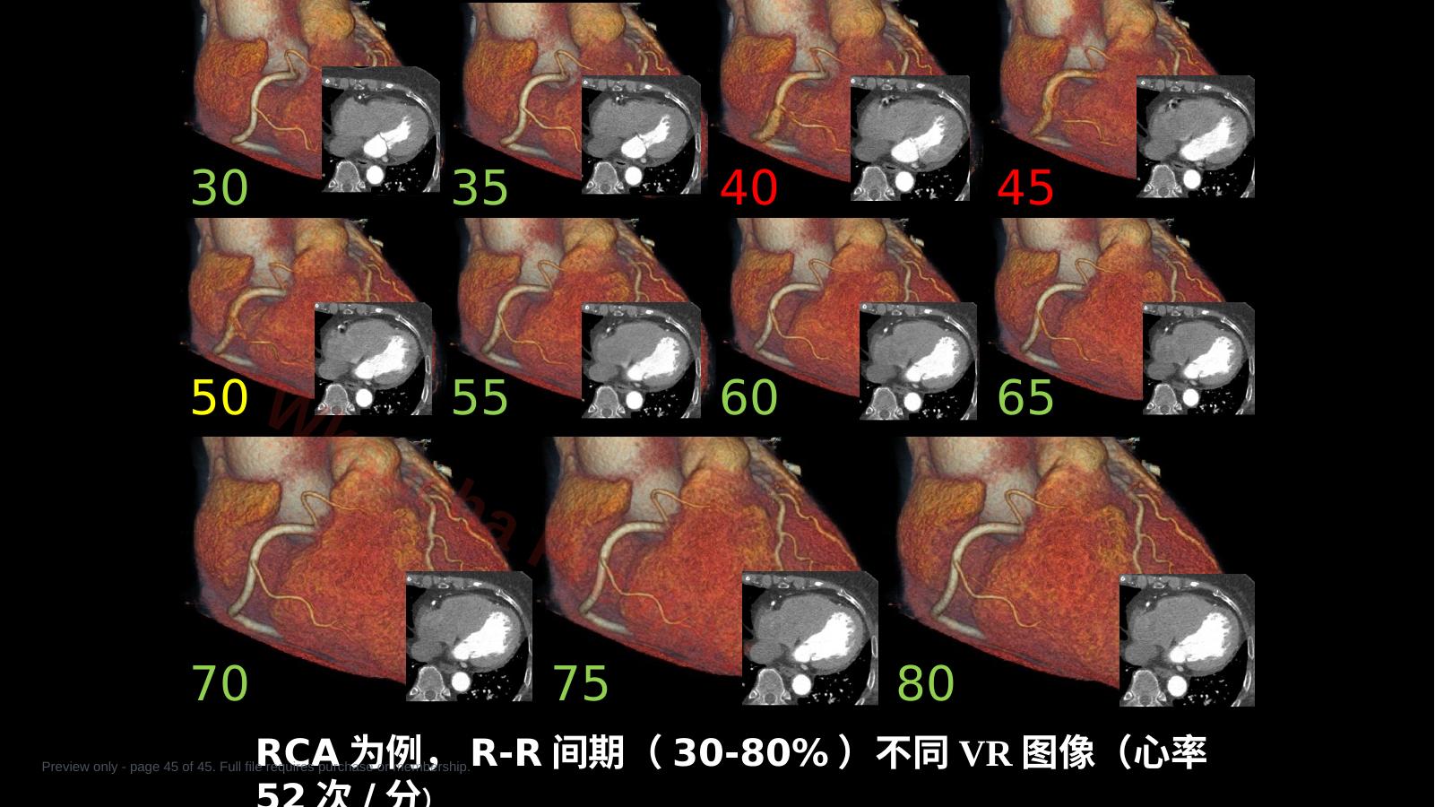 预览第 45 页